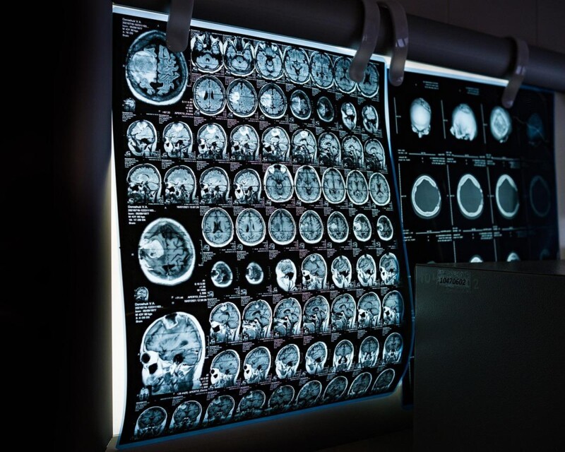 mitrey-x-ray-6841384_1280